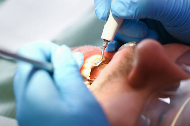 Best Orthodontic Emergency Dentist in Marysville, PA