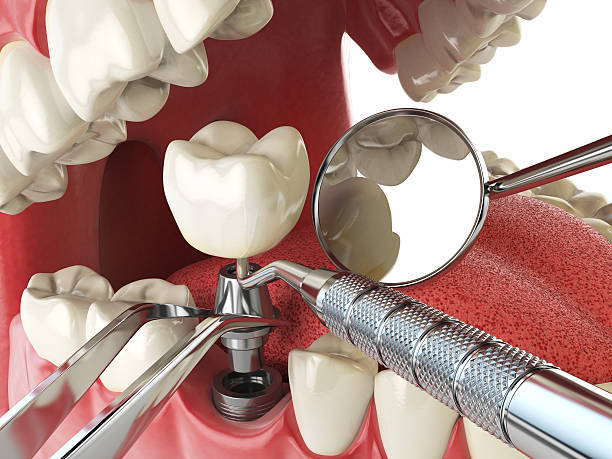 Best Broken or Cracked Tooth Emergency Dentist in Marysville, PA
