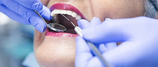 Best Emergency Dental Care for Abscessed Tooth in Marysville, PA